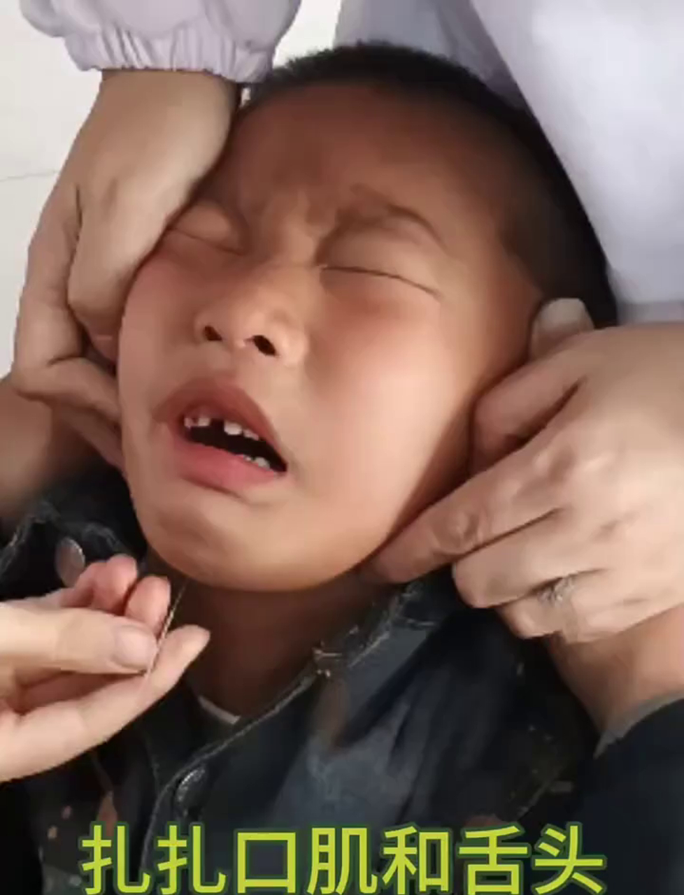 孩子现在正练习嘴部和舌头,开启说话技能用专业技巧刺激口腔肌肉
