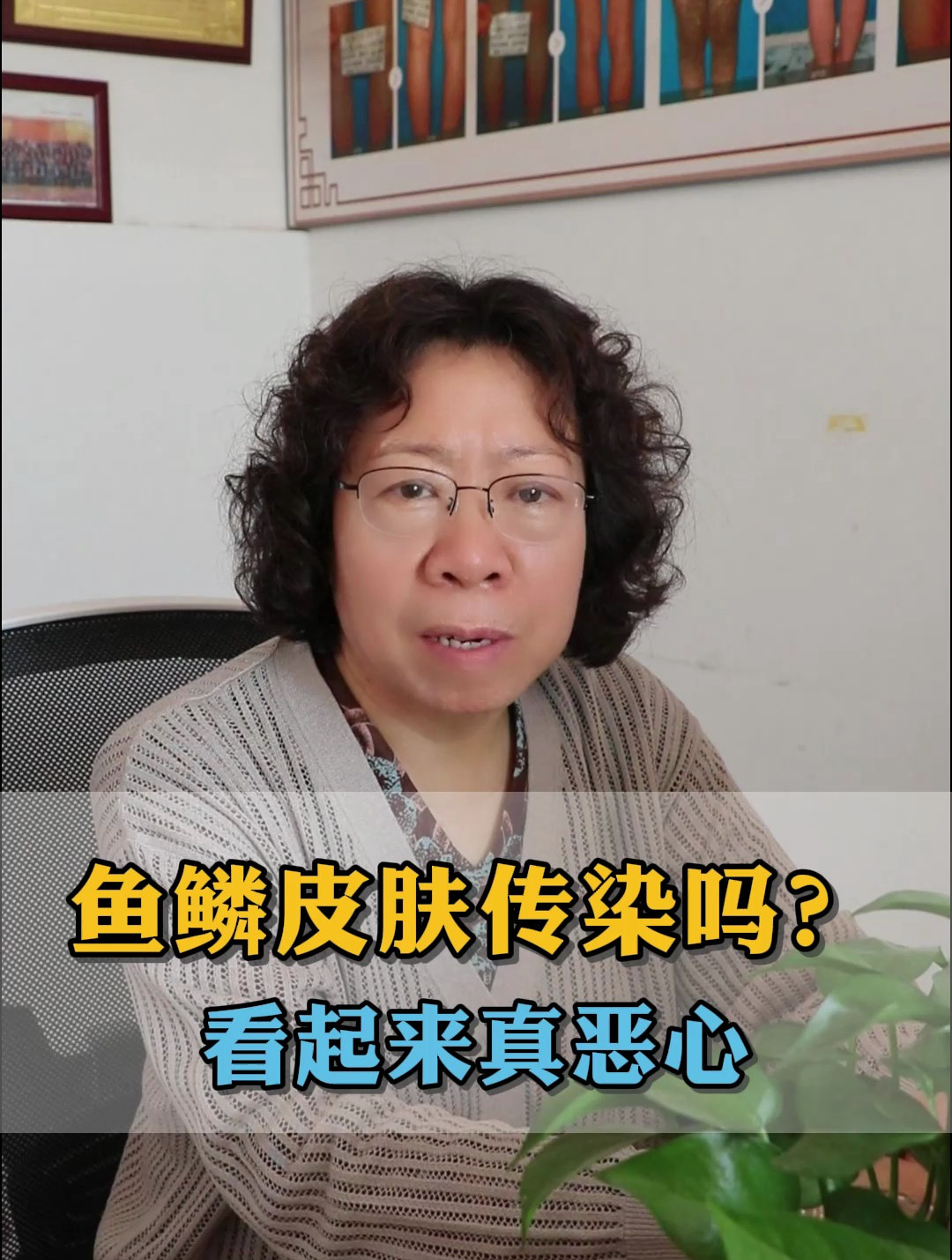鱼鳞皮肤传染吗?看起来真恶心