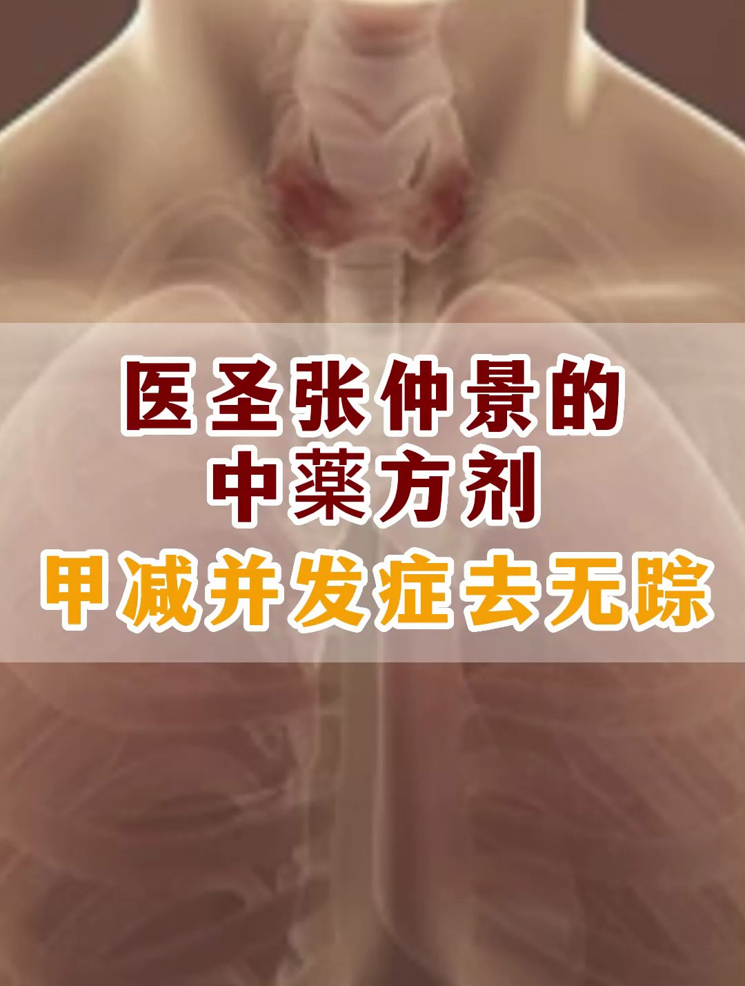 张仲景的中薬方剂!食用下来,甲减并发症去无