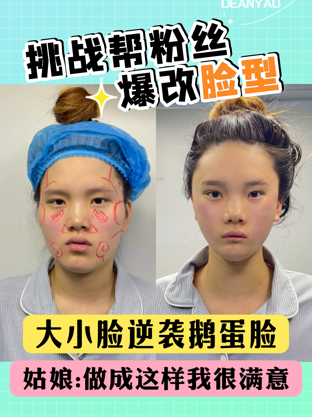 “做成这样我很满意”,姑娘到底做了什么?从大小脸—鹅蛋脸!