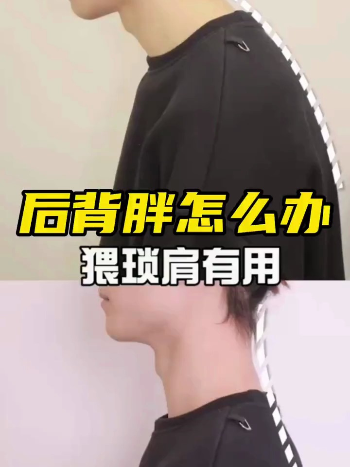 后背肉多的姐妹一定要学会这个
