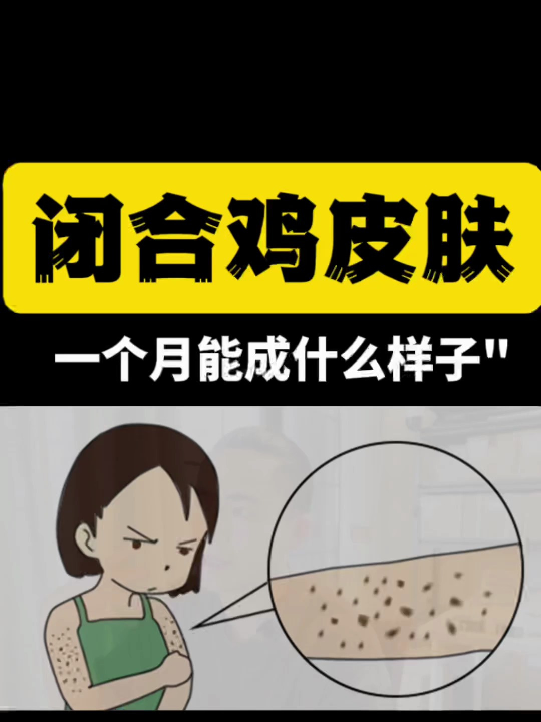 手臂应该都是这种鸡皮肤吧