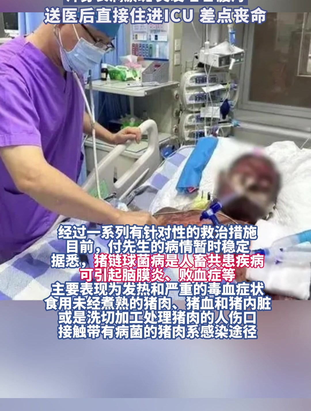 广州一男子带伤切猪肉,感染猪链球菌病菌,浑身长满瘀斑