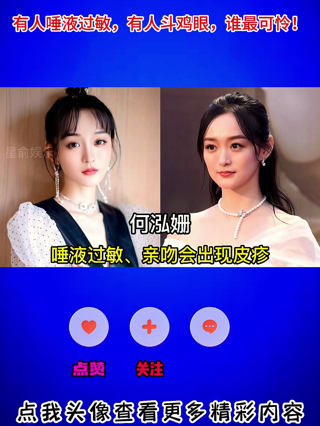 身体有缺陷的明星?有人唾液过敏,有人斗鸡眼,谁最可怜!