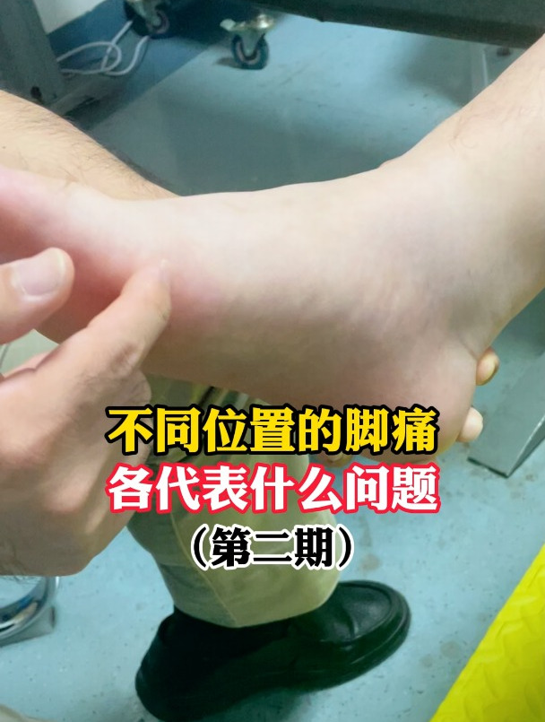 不同位置的脚痛各代表什么问题?第二期