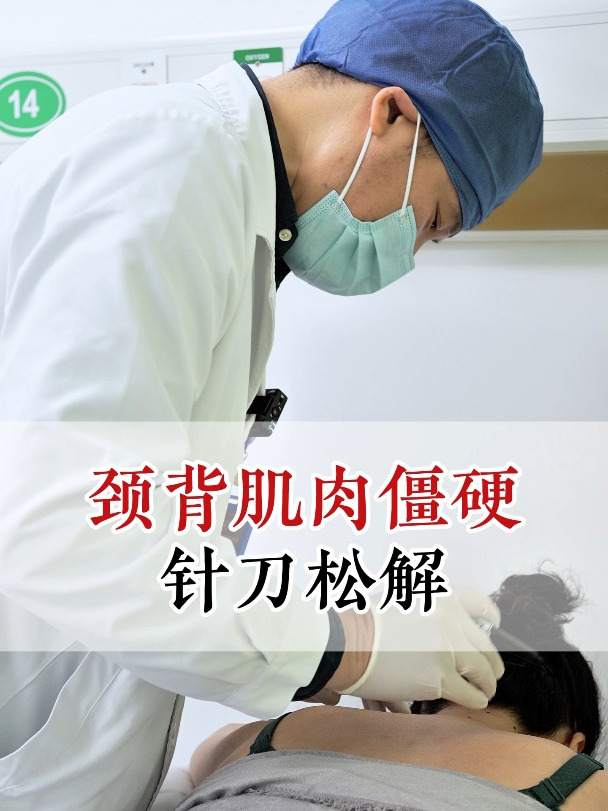颈背肌肉僵硬,针刀松解