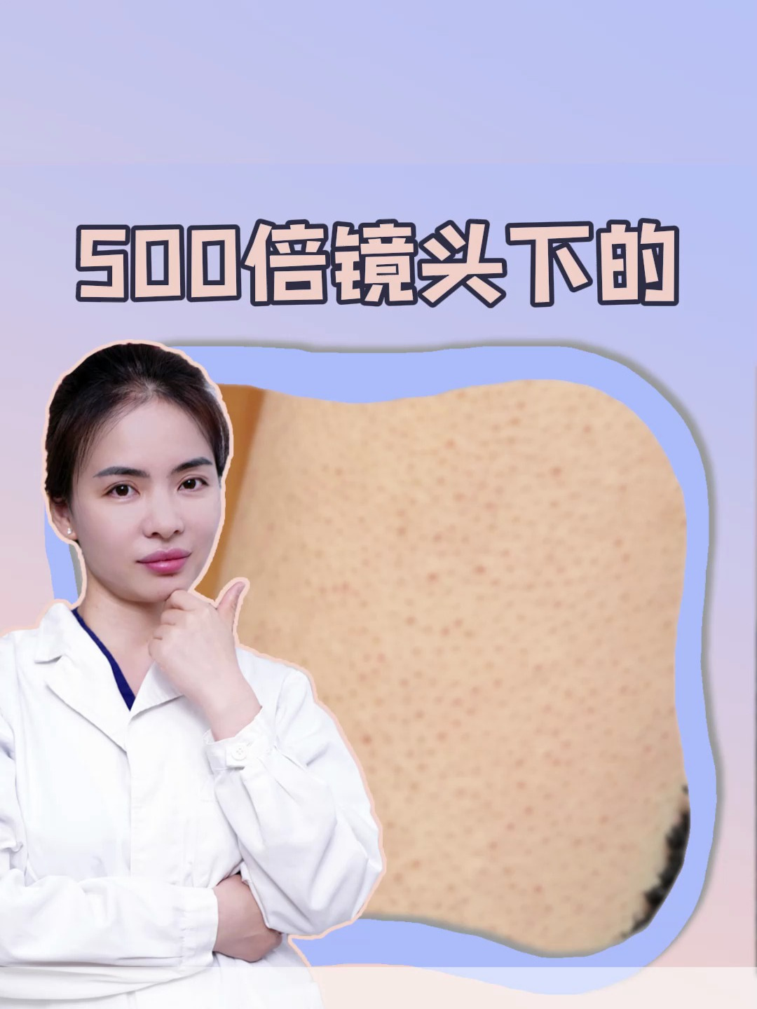 鸡皮肤在高清500倍镜头下的样子你见过吗