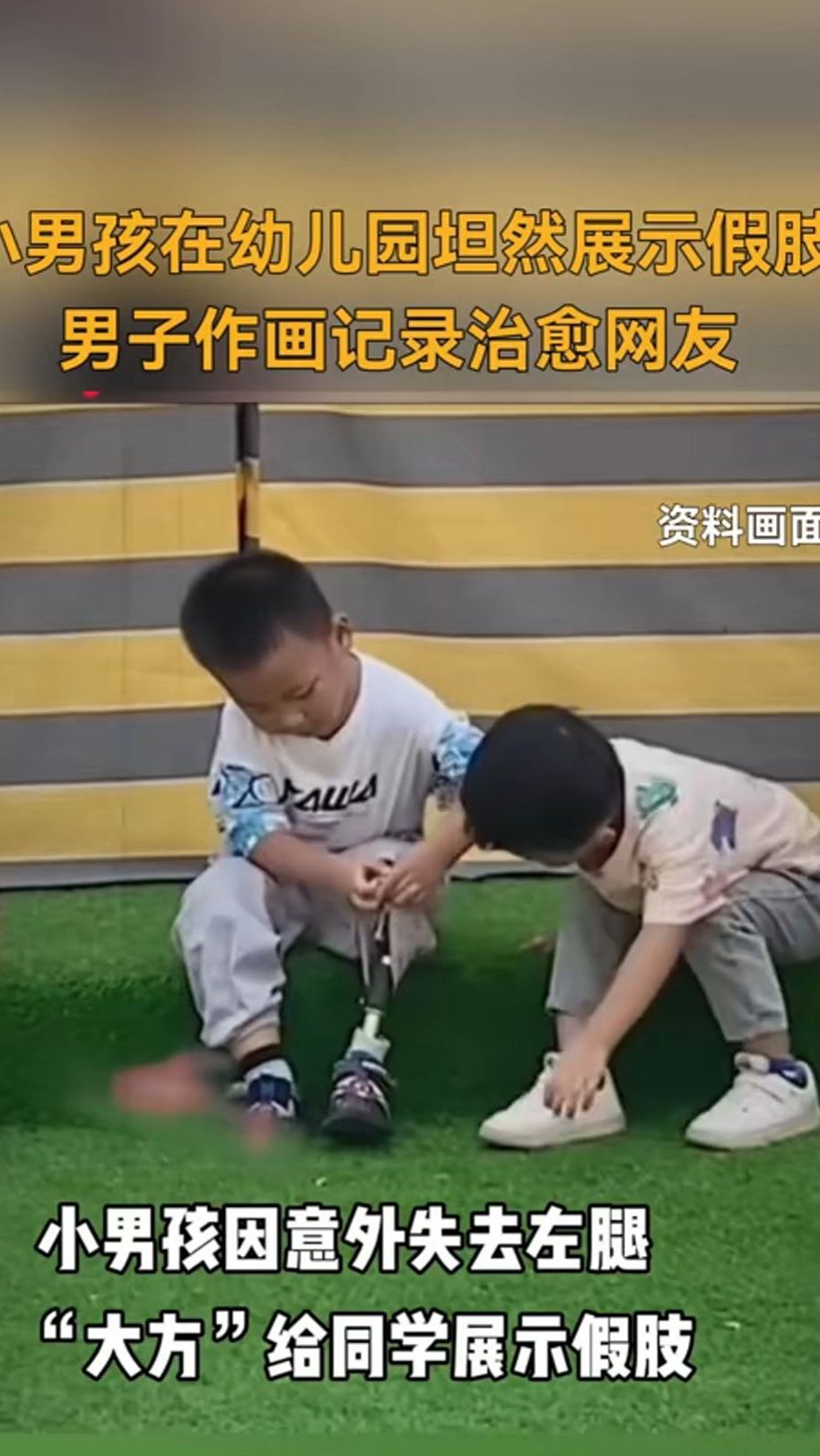 小男孩在幼儿园坦然展示假肢,男子作画记录治愈网友