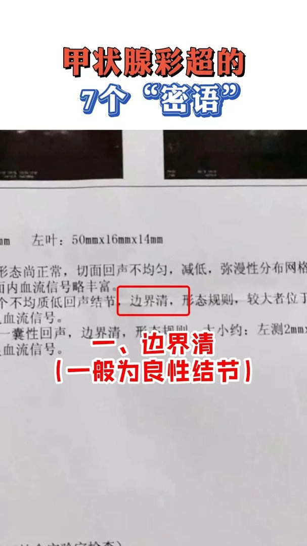 甲状腺彩超 报告单怎么看?