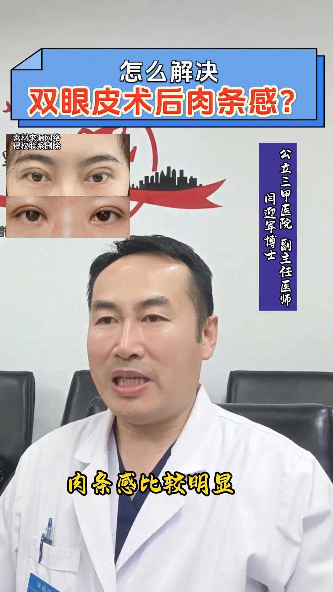 怎么解决双眼皮术后肉条感?