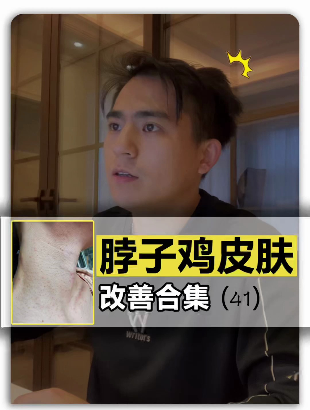 鸡皮肤改善合集(41)