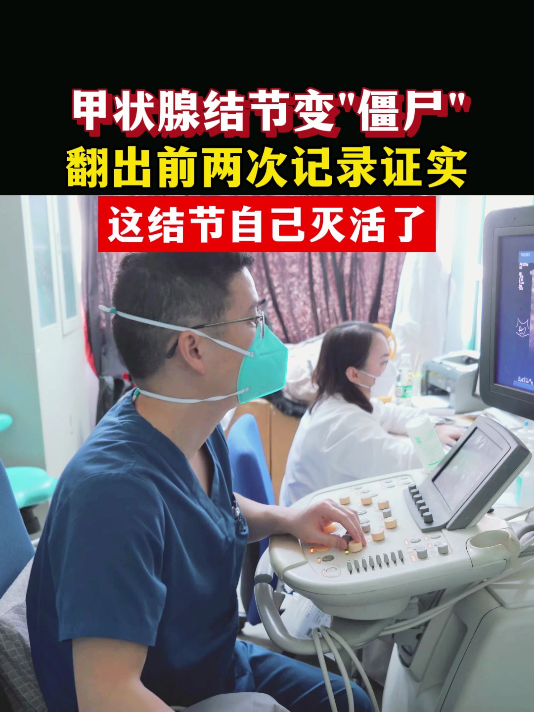 甲状腺结节变“僵尸”,翻出前两次记录证实,结节自己灭活了