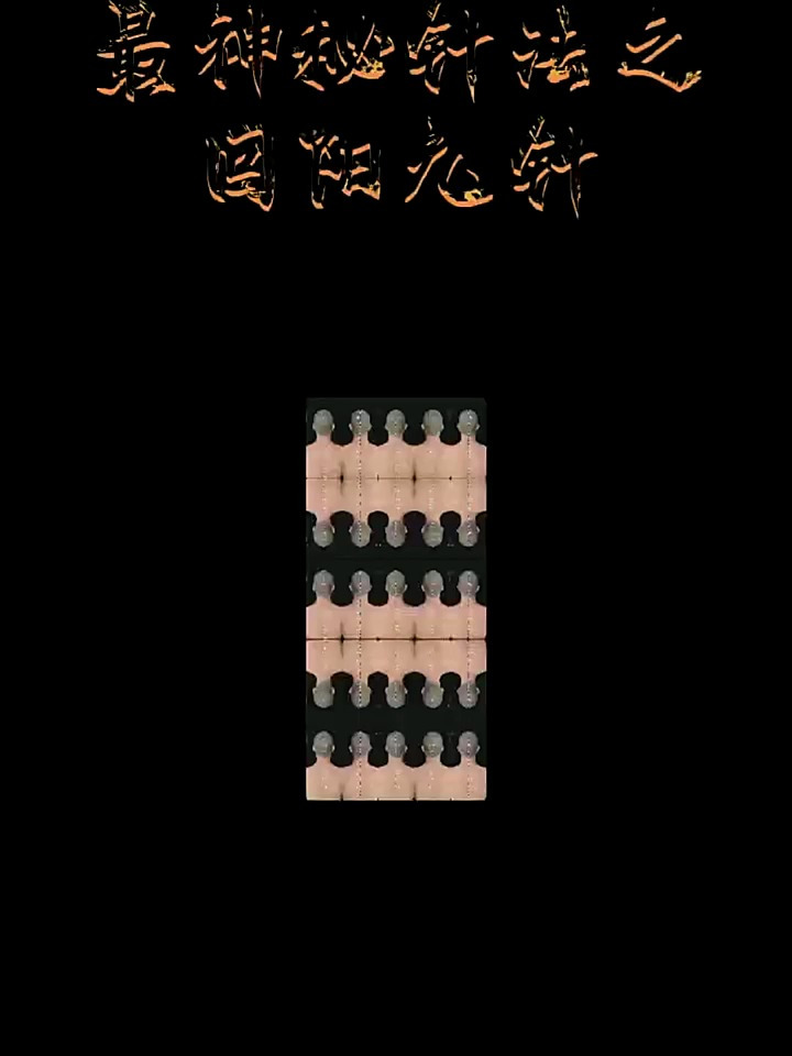 回阳九针最神奇也是最神秘的针法
