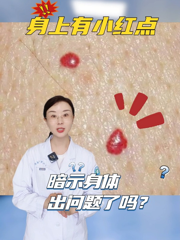 身体长这种小红点是出问题了吗?