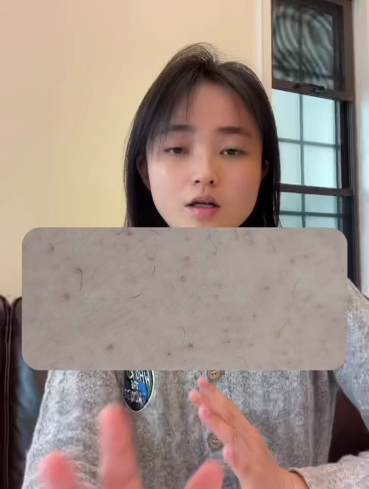 鸡皮肤引起的发红