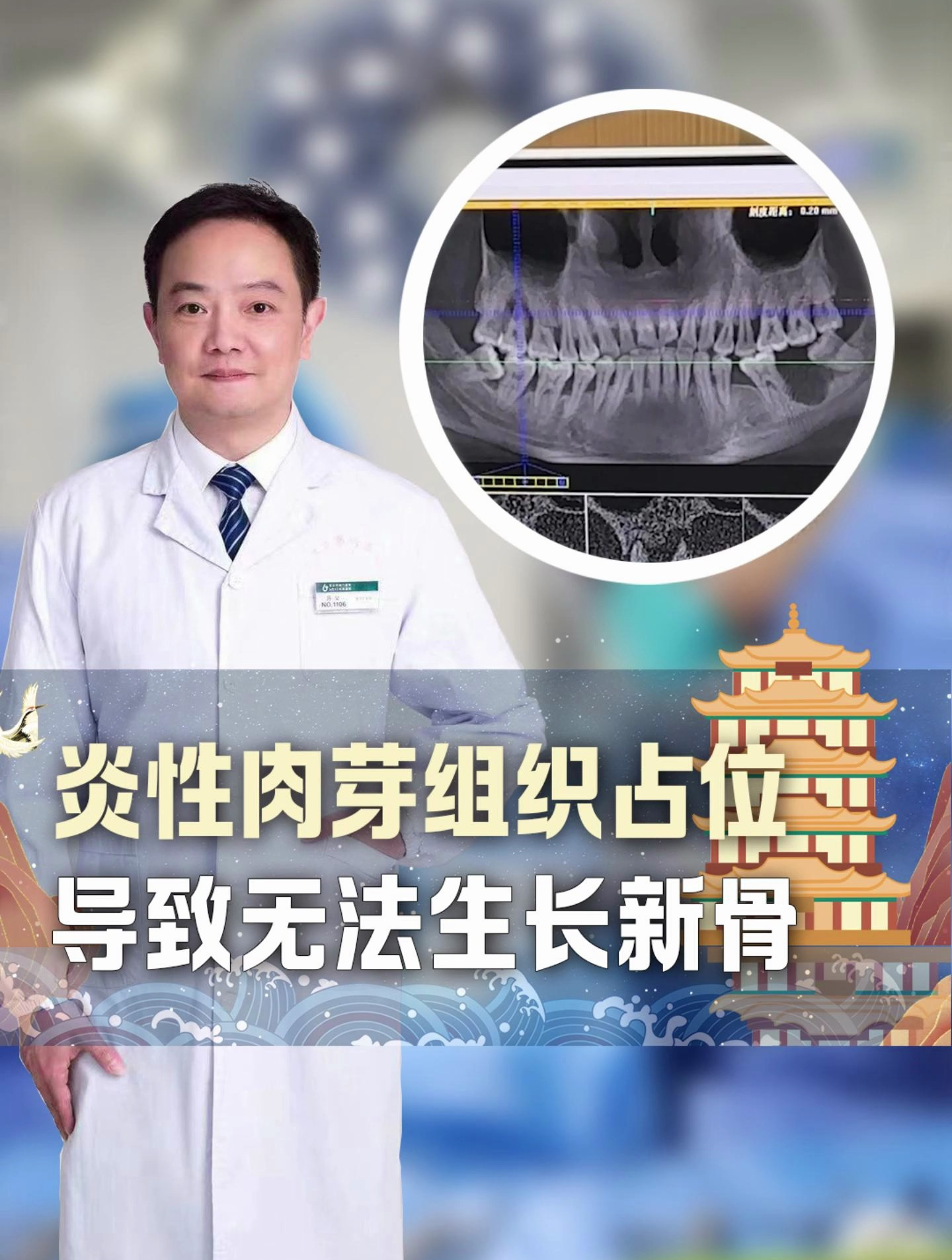 炎性肉芽组织占位导致无法生长新骨