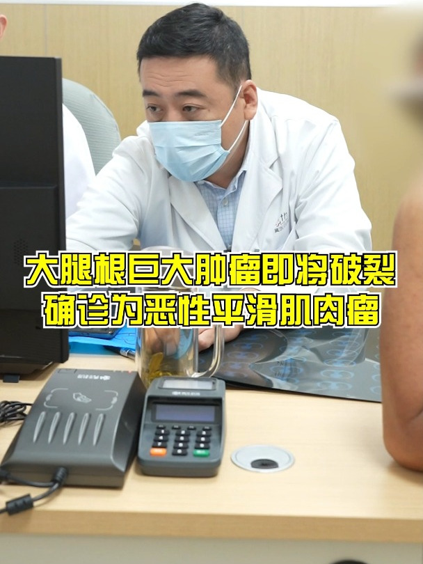 大腿根巨大肿瘤即将破裂确诊为恶性平滑肌肉瘤