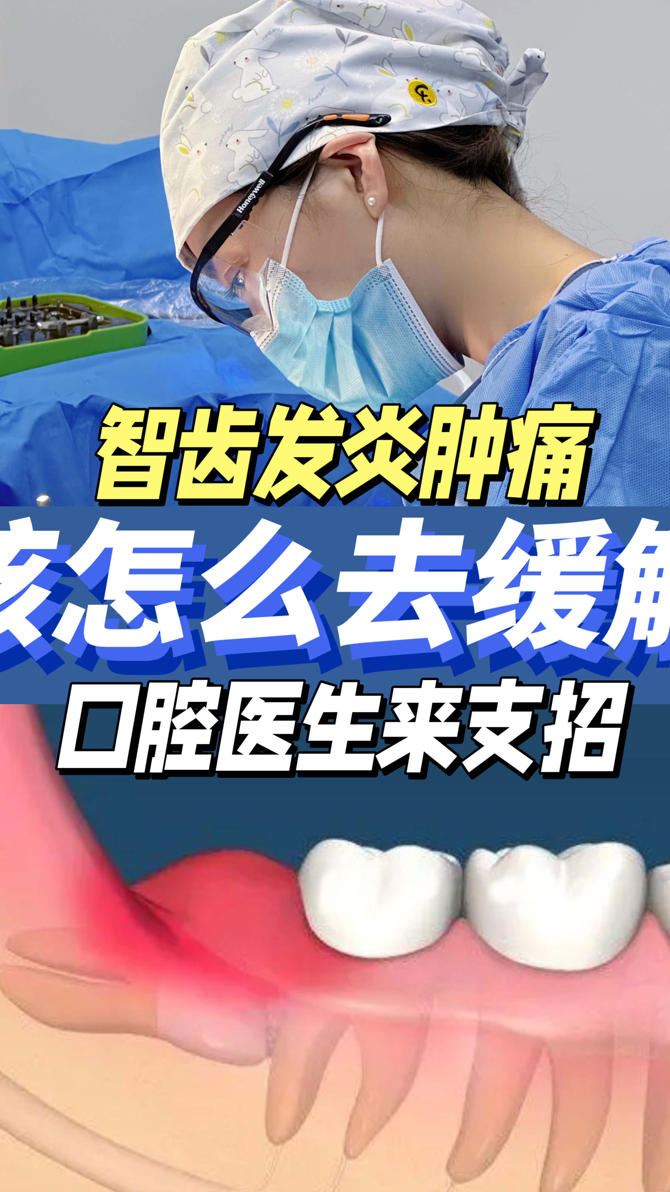 智齿牙龈肿痛怎么办?