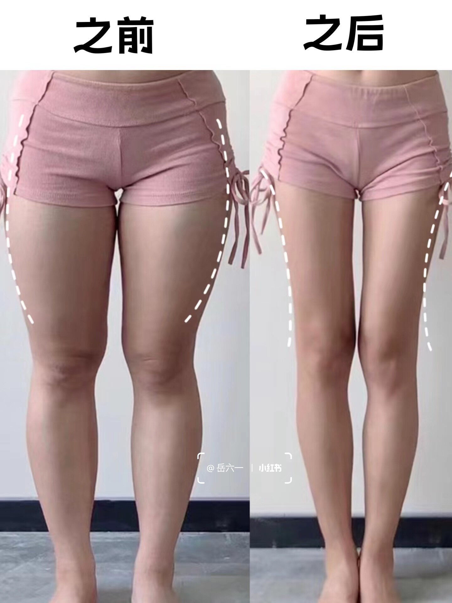 真的很绝 大腿肌肉外翻/假跨宽练这5个动作