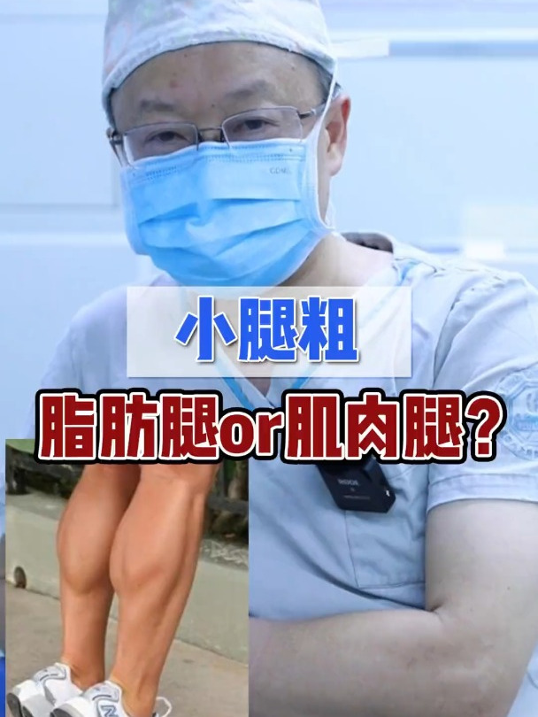 小腿粗 如何判断脂肪腿 还是 肌肉腿?
