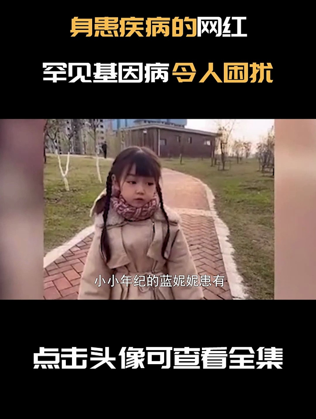 身患疾病的网红,为了挣钱拖垮身体,罕见基因病令人困扰