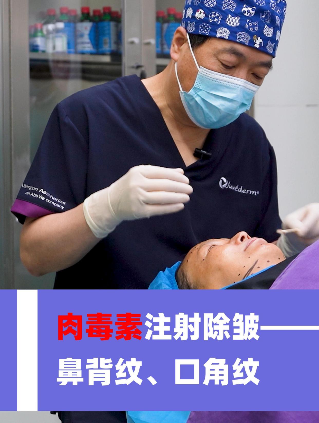 肉毒素注射除皱——鼻背纹、口角纹