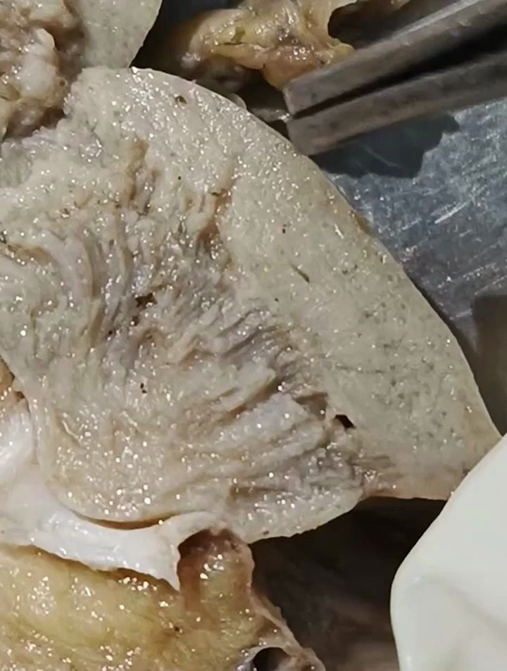人体肾脏的内部结构,第一次以这种方式呈现