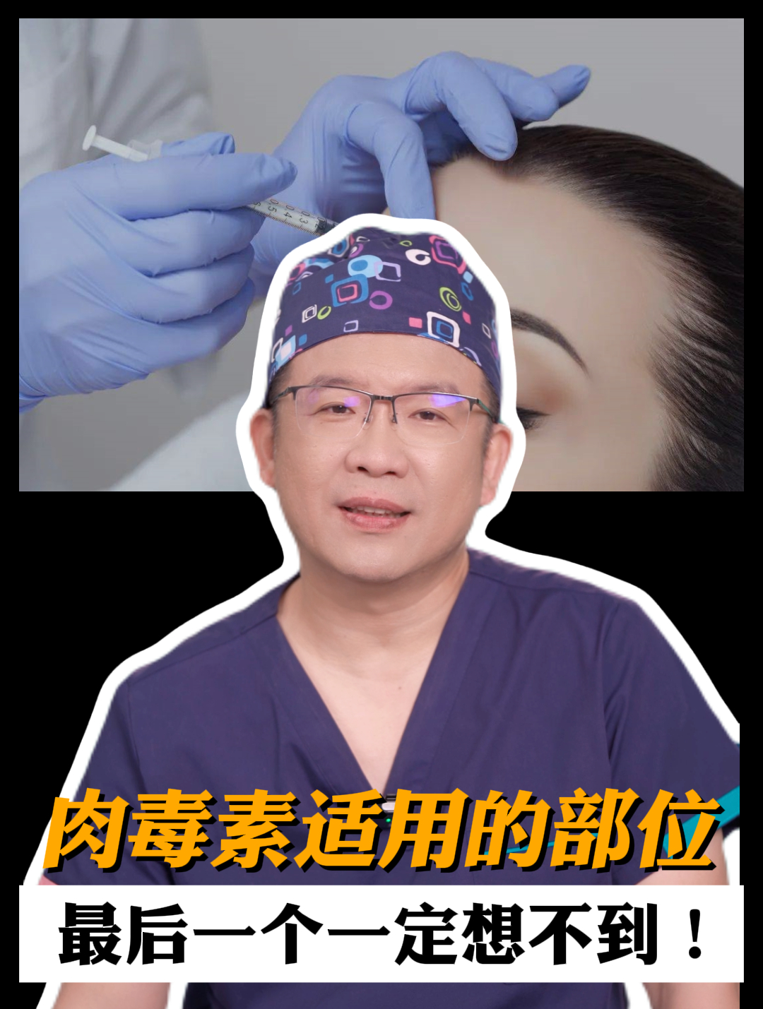 肉毒素适用于哪些部位的改善,最后一个你一定想不到!