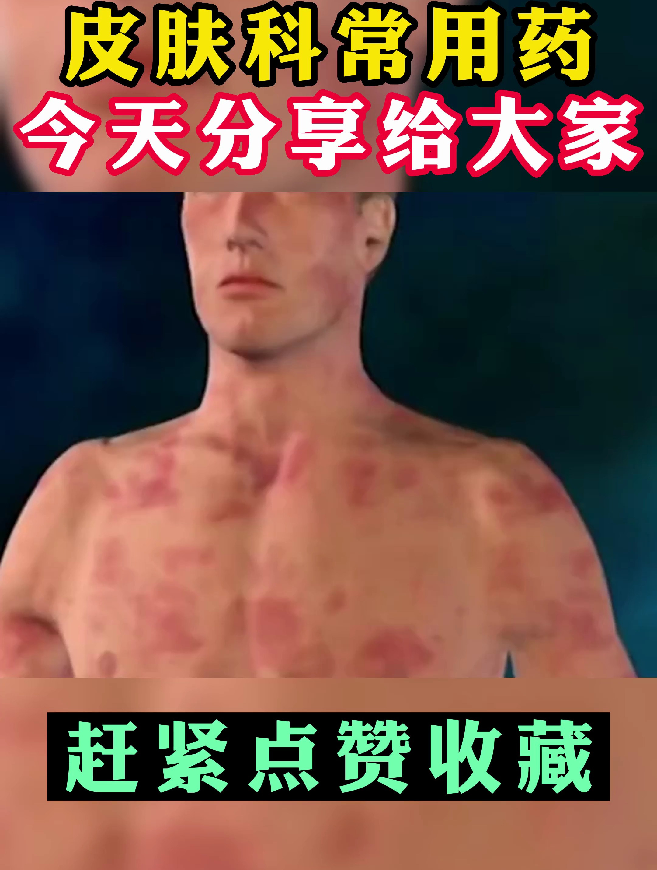 皮肤科常用药今天分享给大家赶紧点赞收藏