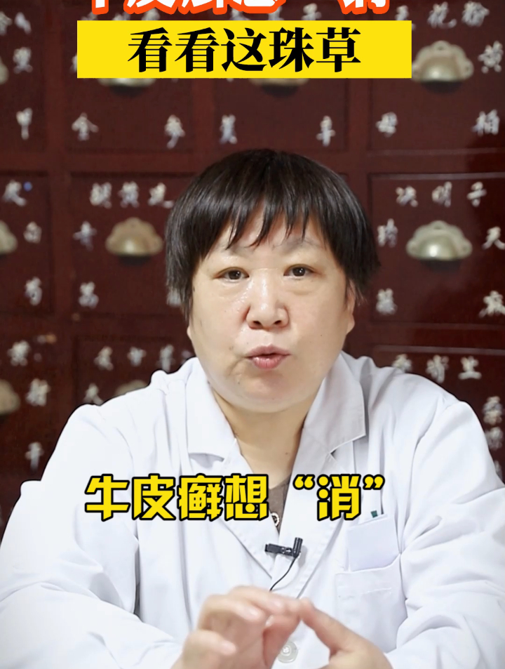 积雪草治银屑病究竟有没有用?医生给出答案了,来看看!