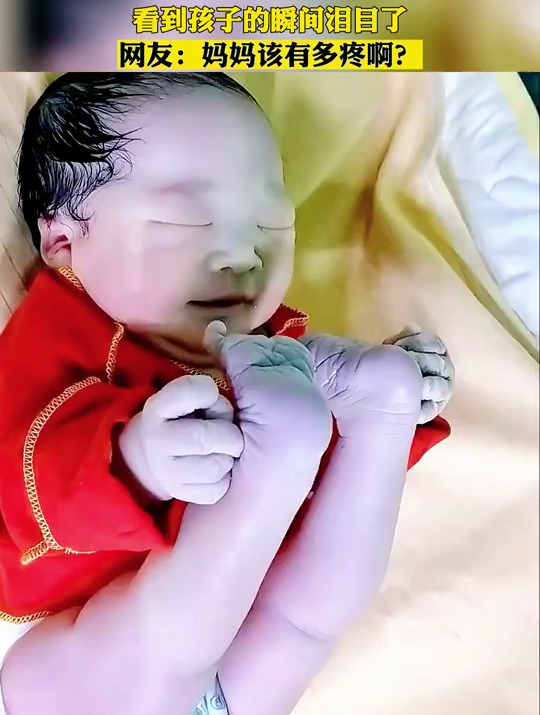 新生儿臀位顺产,看到孩子的瞬间泪目了,网友:妈妈该有多疼啊?