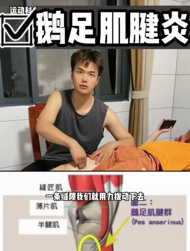 膝盖内侧不适 是哪里出现了问题?