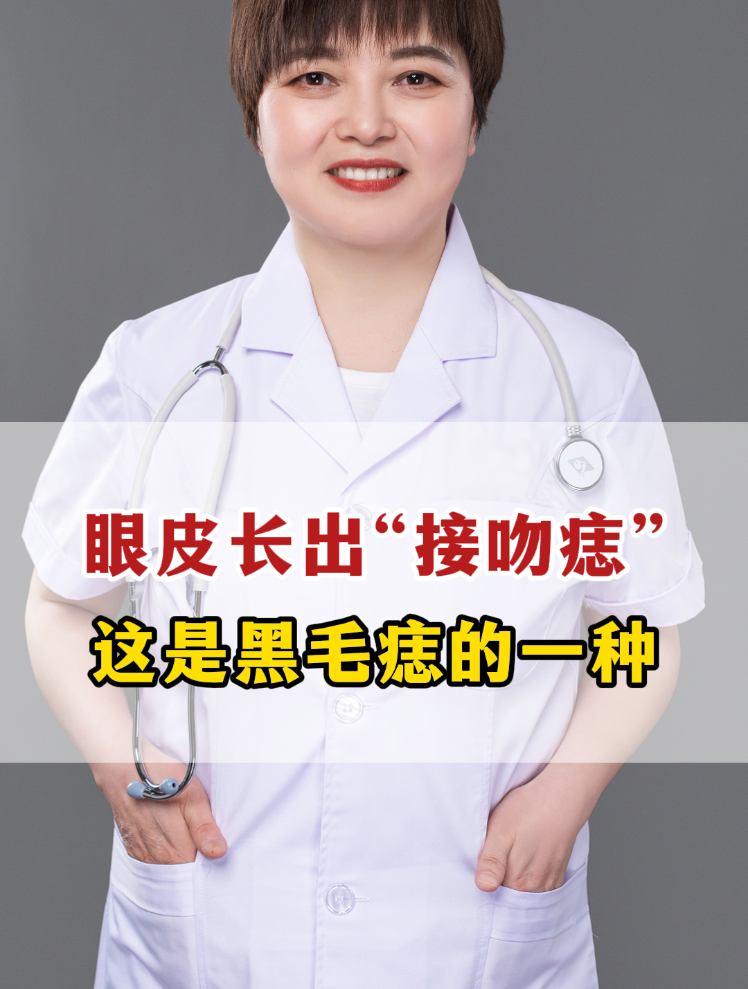 眼皮长出“接吻痣”,这种是黑毛痣的一种