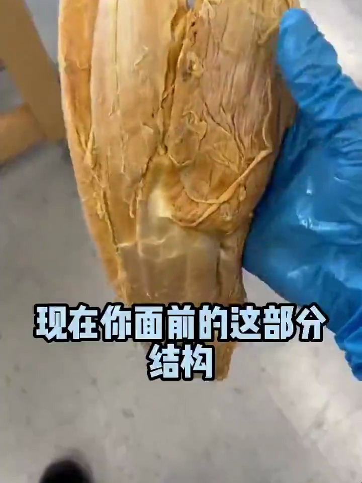 真实人体标本小腿跟腱,肌肉纹理清晰可见,致敬大体老师