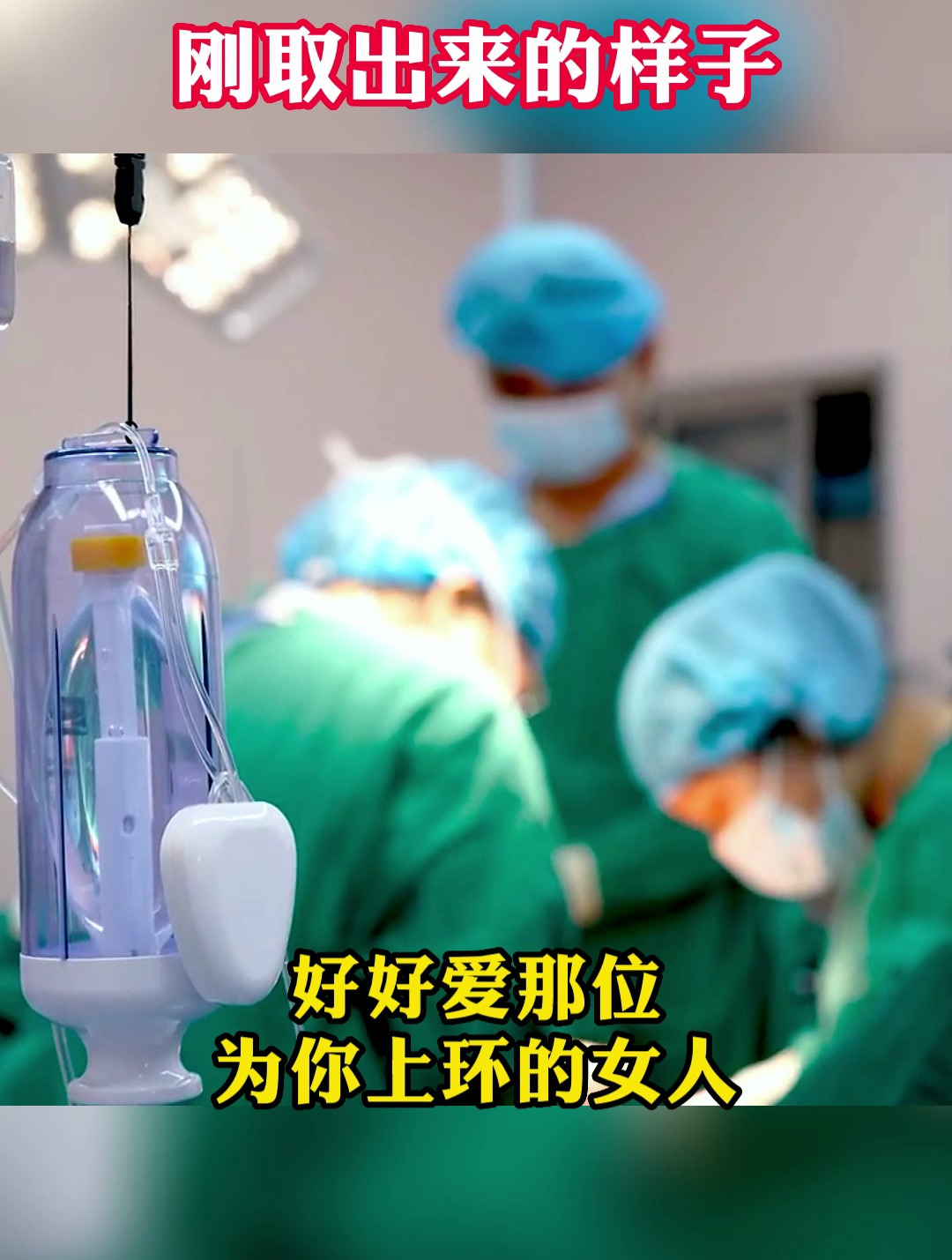 有一种痛叫取环,长期不取会嵌入肉内