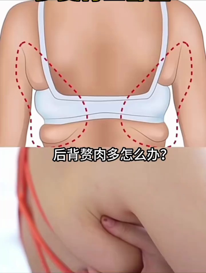后背赘肉多如何瘦下去?