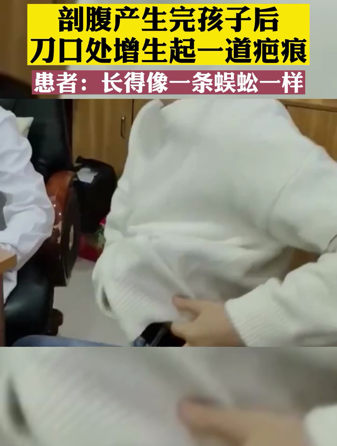 剖腹产生完孩子后,刀口处增生起一道疤痕!