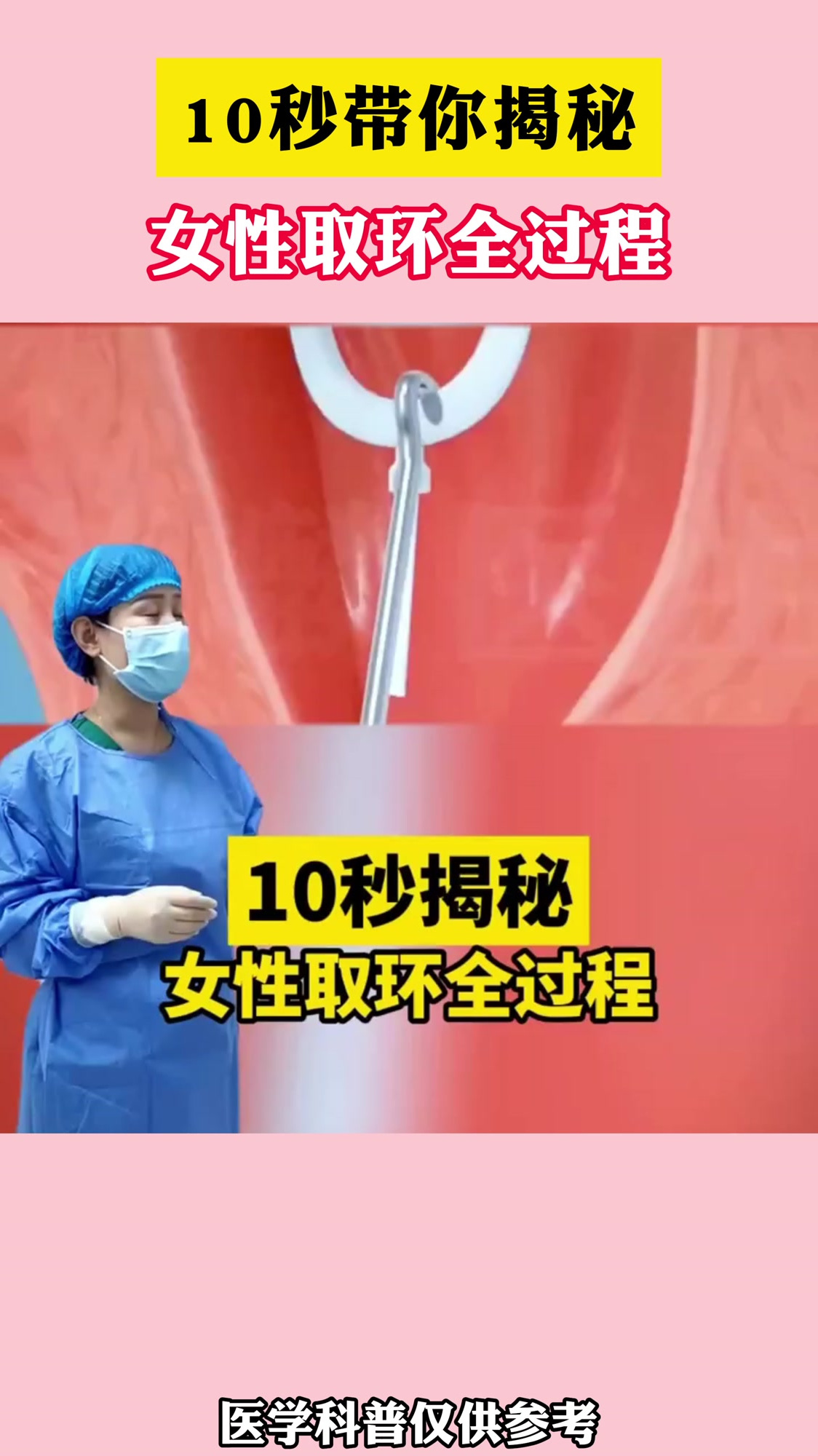 10秒带你揭秘,女性取环全过程