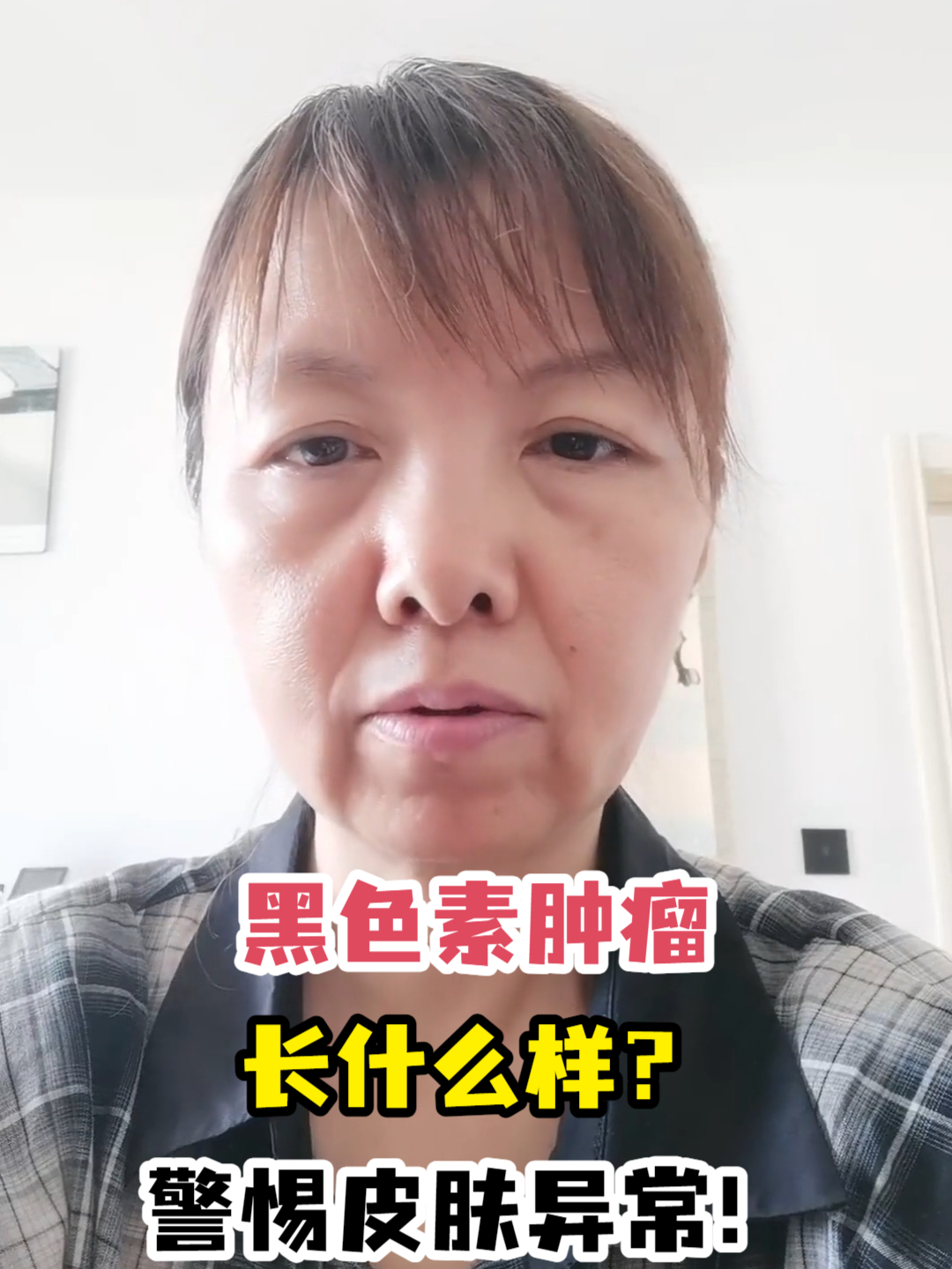 黑色素肿瘤长什么样?警惕皮肤异常!
