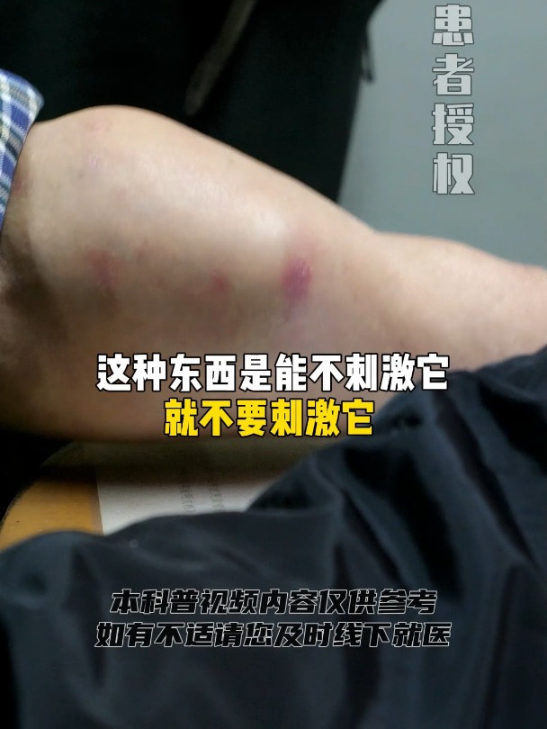 小臂的恶性肉瘤