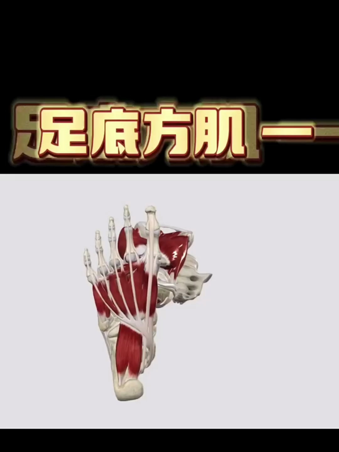 一块导致足底痛的肌肉——足底方肌