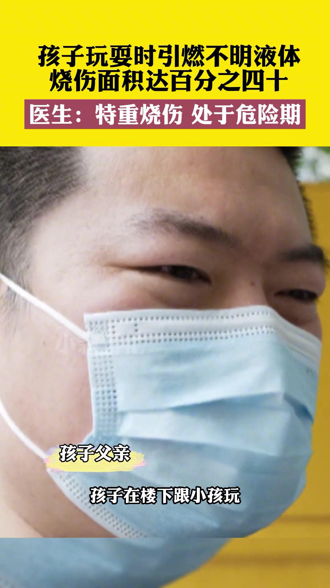 5月20日河南郑州,孩子玩耍时引燃不明液体,烧伤面积达百分之四十,医生:特重烧伤,处于危险