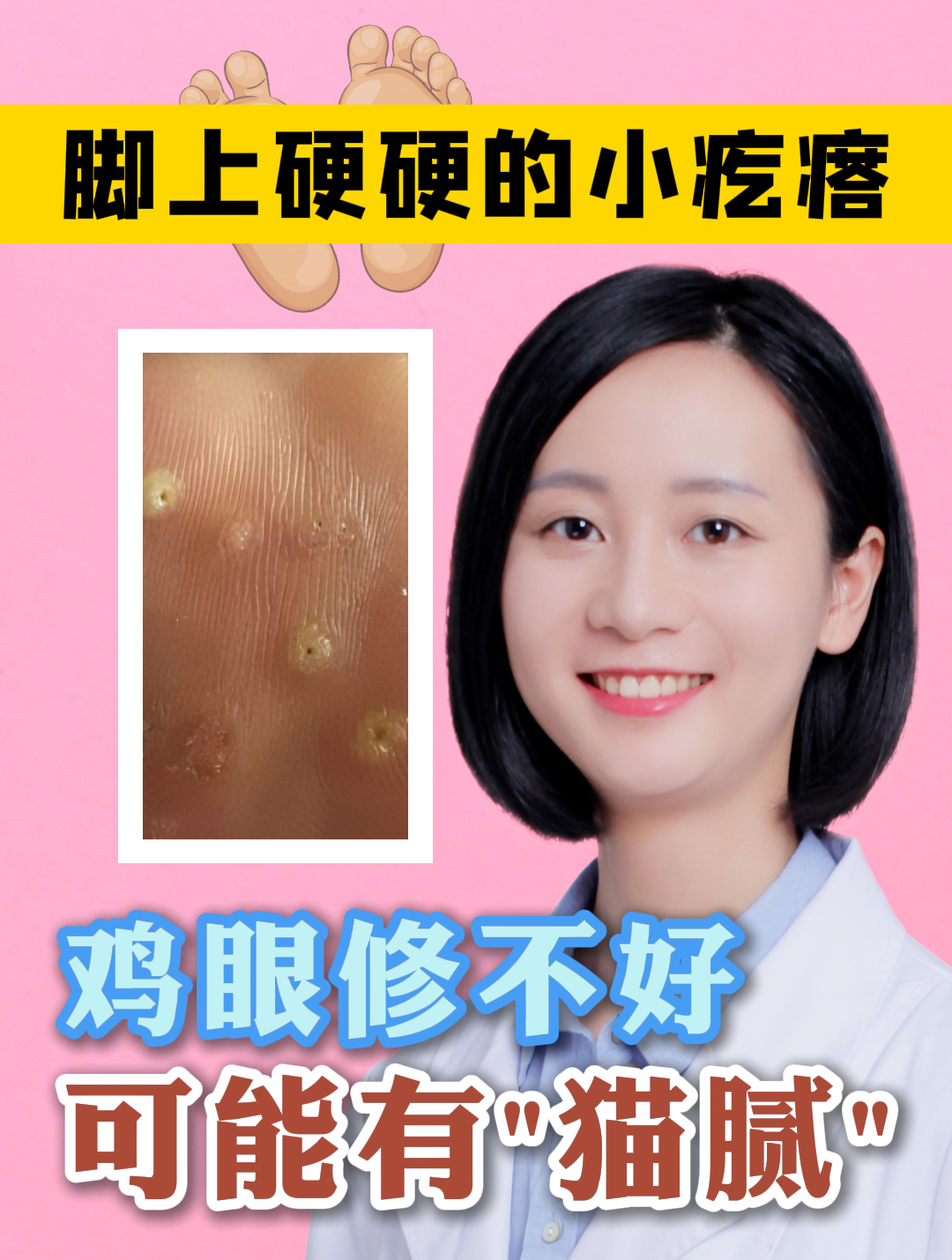 鸡眼修不好 可能有猫腻