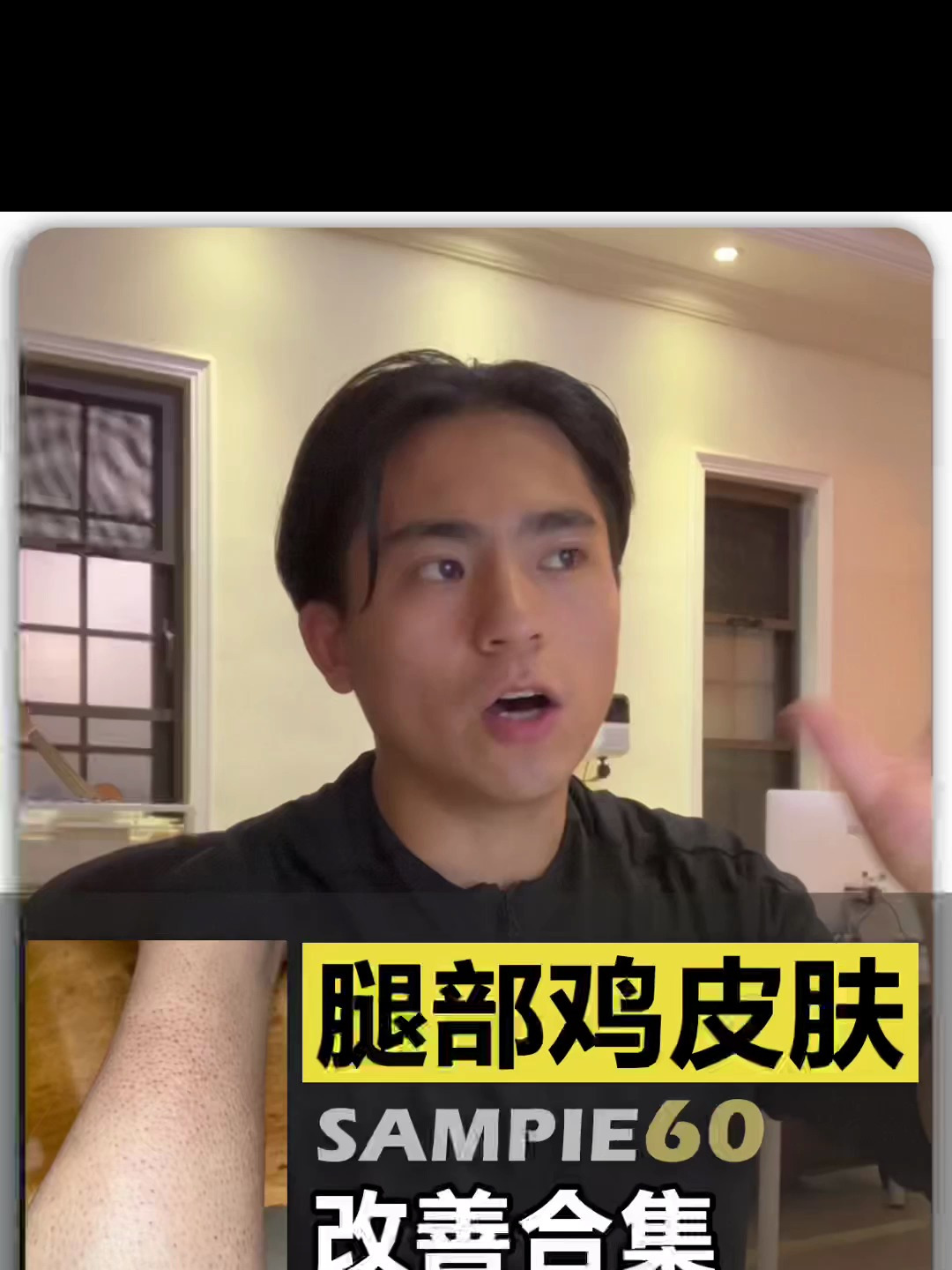 鸡皮肤改善合集(60)