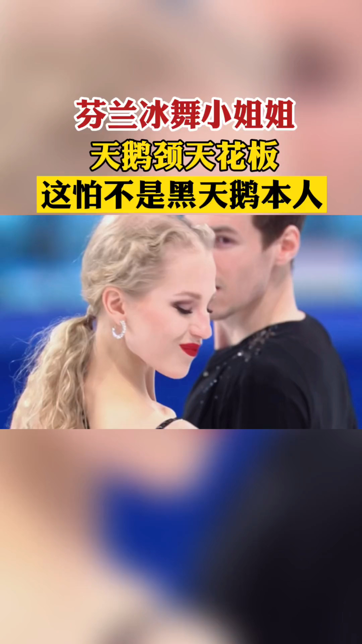 手臂的肌肉线条也好好看,这大概就是黑天鹅本人吧