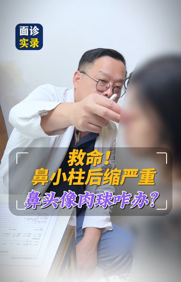 救命!鼻小柱后缩严重鼻头像肉球咋办?还能修复吗?
