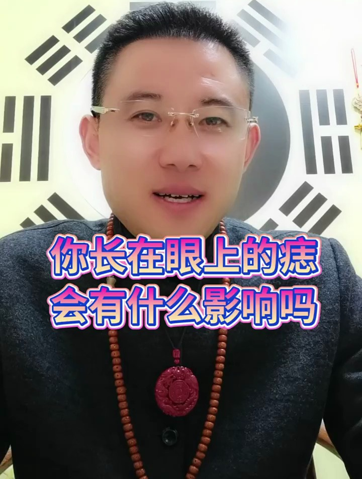 长在眼睛上的痣会有什么影响?