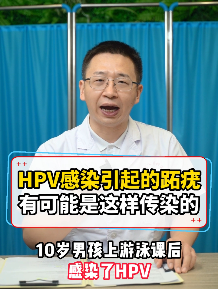 HPV感染引起的跖疣,有可能是这样传染的