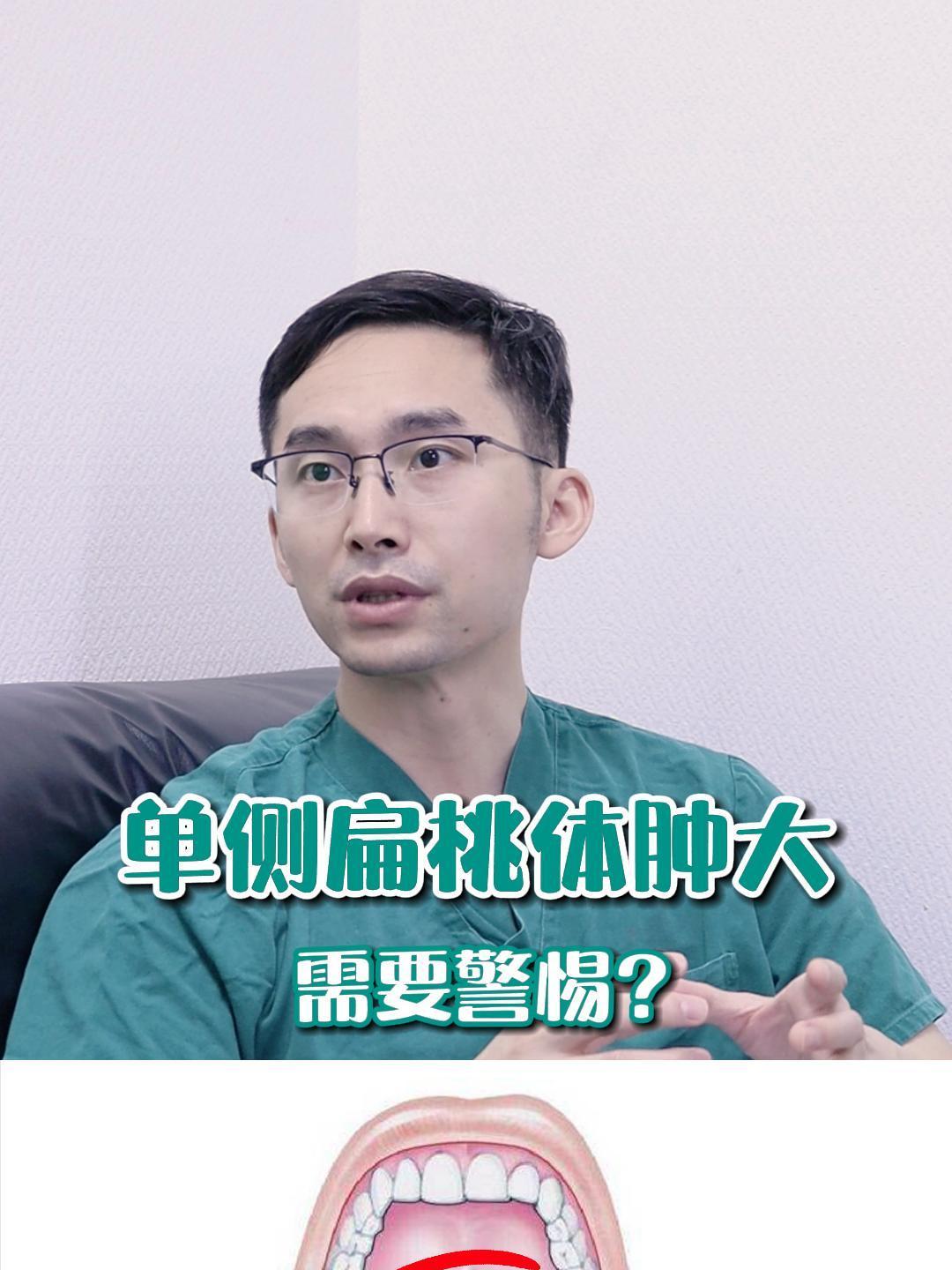 单侧扁桃体肿大要警惕