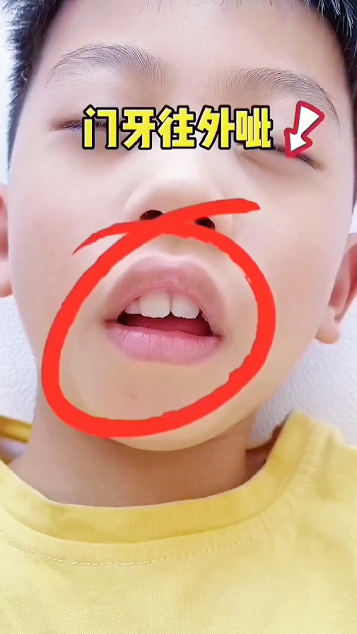 再怎么不信都要试试才知道效果!孩子睡觉嘴唇凸起真的需要重视!
